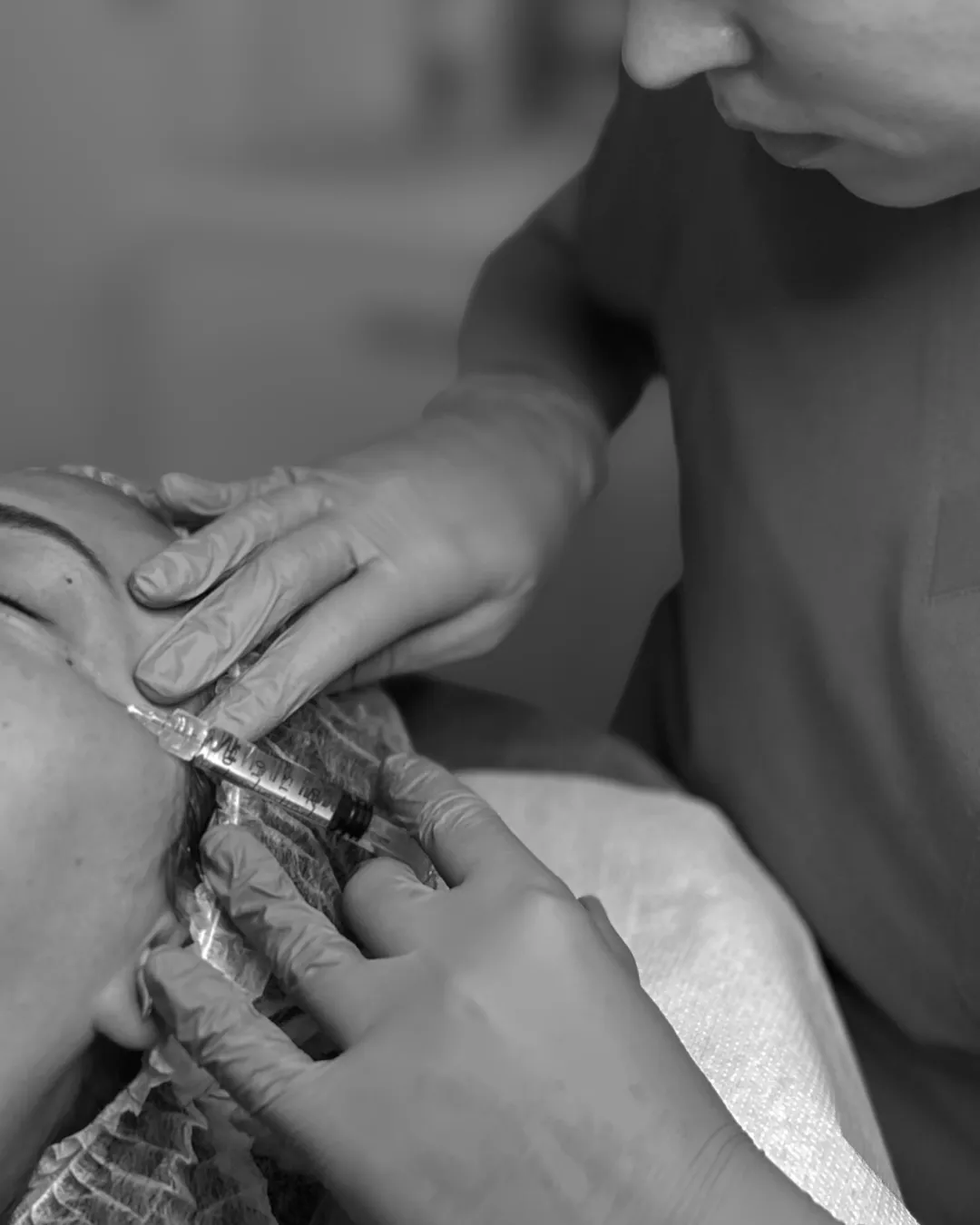 Mezoterapia igłowa (3)