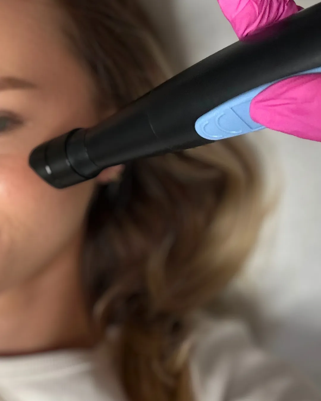 Konsultacja z dedykowanym beauty-planem i analizą w USG skóry